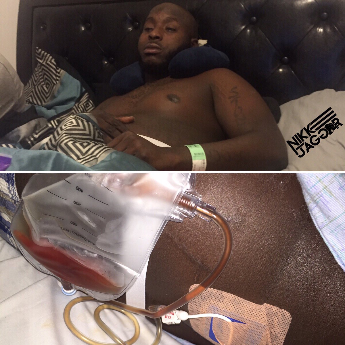 JaggerOnDatJunt's tweet photo. My kidney is failing, I'm on bed rest. But do u think Ima let that stop me from reaching my goals &amp; making this music? Fuck no #KickinIn 💊 https://t.co/ey6TeQtiVp