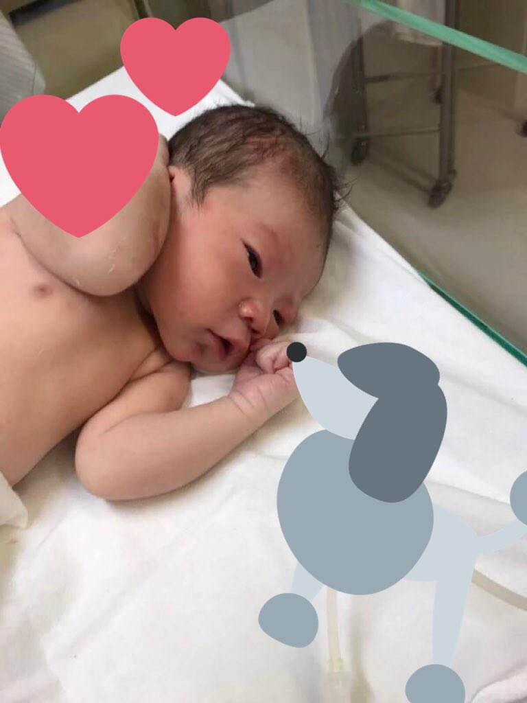 m_i223s's tweet photo. 2016.11.15(火) AM３：５４
3010g 50cm 男の子誕生👶🏻💓❤️
陣痛死ぬほど痛かったけどずーっと隣で手を握ってくれた旦那と応援してくれてたみんなのおかげで耐えられた！ベビたんも頑張ったね💓ママとパパの所に生まれてきてくれてありがとう😌❤️ https://t.co/SXW5mWTsn8