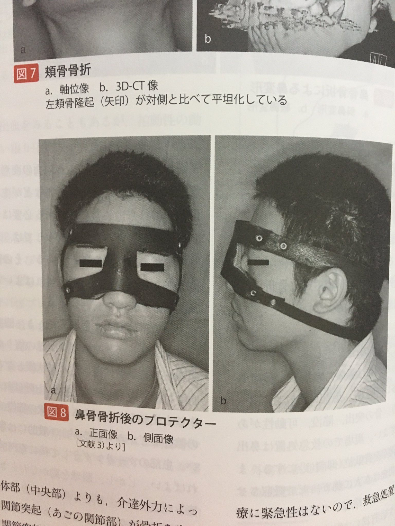 ともや 鼻折れて鼻血ブーしながら朝ヤンに怒られてたキャプテン思い出す T Co Dpoecannqc Twitter