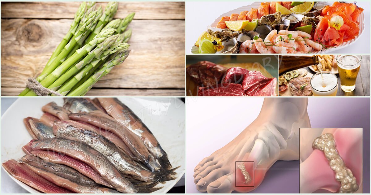 CodeLucid's tweet image. Here are the Types of Food that Cause #Gout &amp;amp; flare-ups of Inflammatory #Arthritis
Does Protein Toxicity cause Gout?
codelucid.blogspot.com/2016/11/Six-Go…