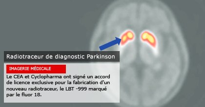 CEA_Officiel's tweet photo. #Parkinson : un nouveau #radiotraceur pour mieux détecter la maladie https://t.co/uupKTuSOJv @Cyclopharma https://t.co/7Kg4ACoyYH