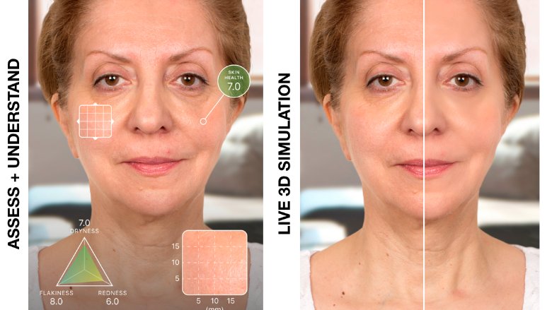 IBM peut détecter les cancers de la peau avec un smartphone fr.express.live/2016/11/15/ibm…