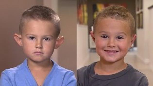 Parents Get 6-Year-Old Plastic Surgery to Help His Self-Esteem j.mp/2cduI5r