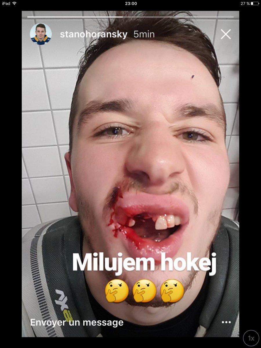 didi_defeo's tweet photo. 😳😱😰🤕 #StanHoransky #ehcb #tonightgame #hockey #Strongman 💪🏼💪🏼 https://t.co/jgdD38efoH