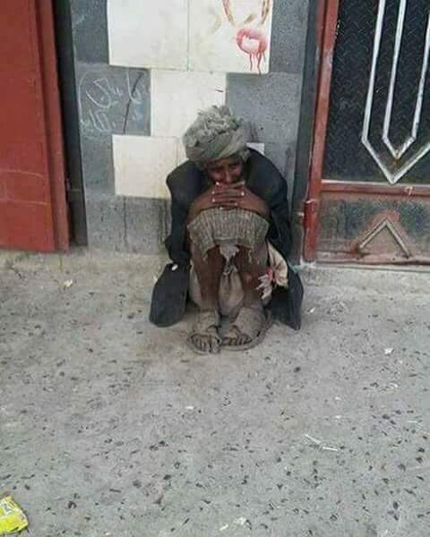 loveYemen101's tweet photo. #TrumpThinkTank 602days of killing Yemenis didn't move the conscience of the world... Is it dead? #ICC4Saudi https://t.co/RQ8DLX7UDY