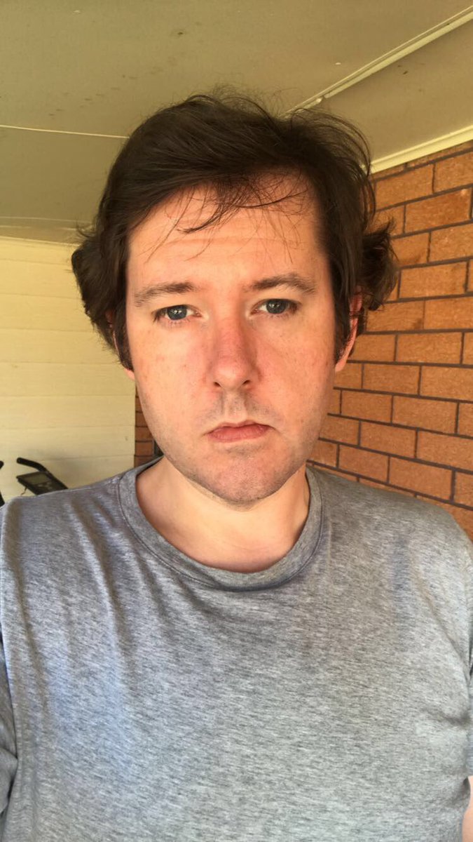 i now have an excuse for my face; "grief ravaged"