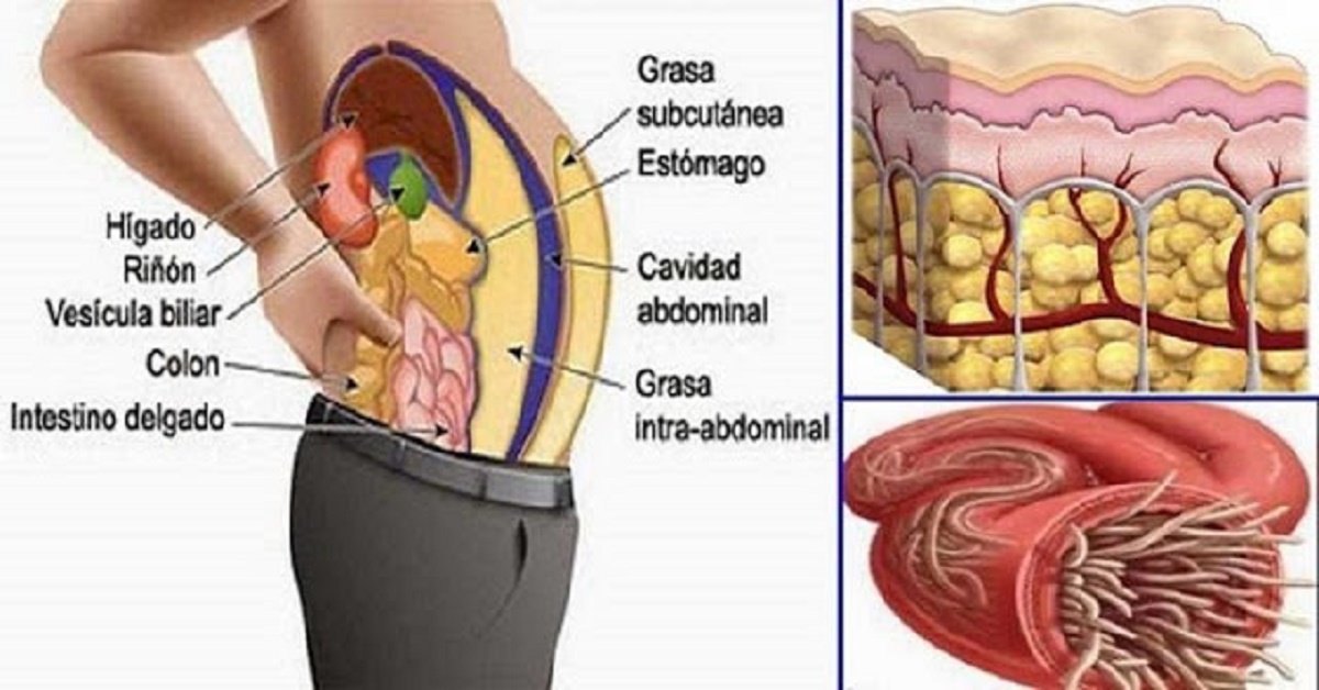 La miel es mala para el intestino