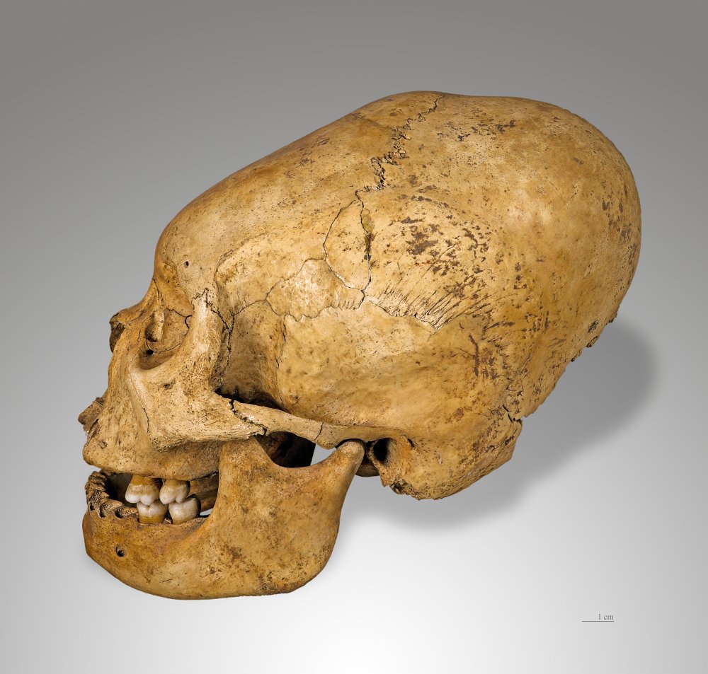 bodyartforms's tweet photo. Fascinating new #BAFblog about Cranial Deformation, check out part 2 of our odd mods blog series! https://t.co/r8pJSLS5Y0 #bodymodification https://t.co/qI2MCMSyZS