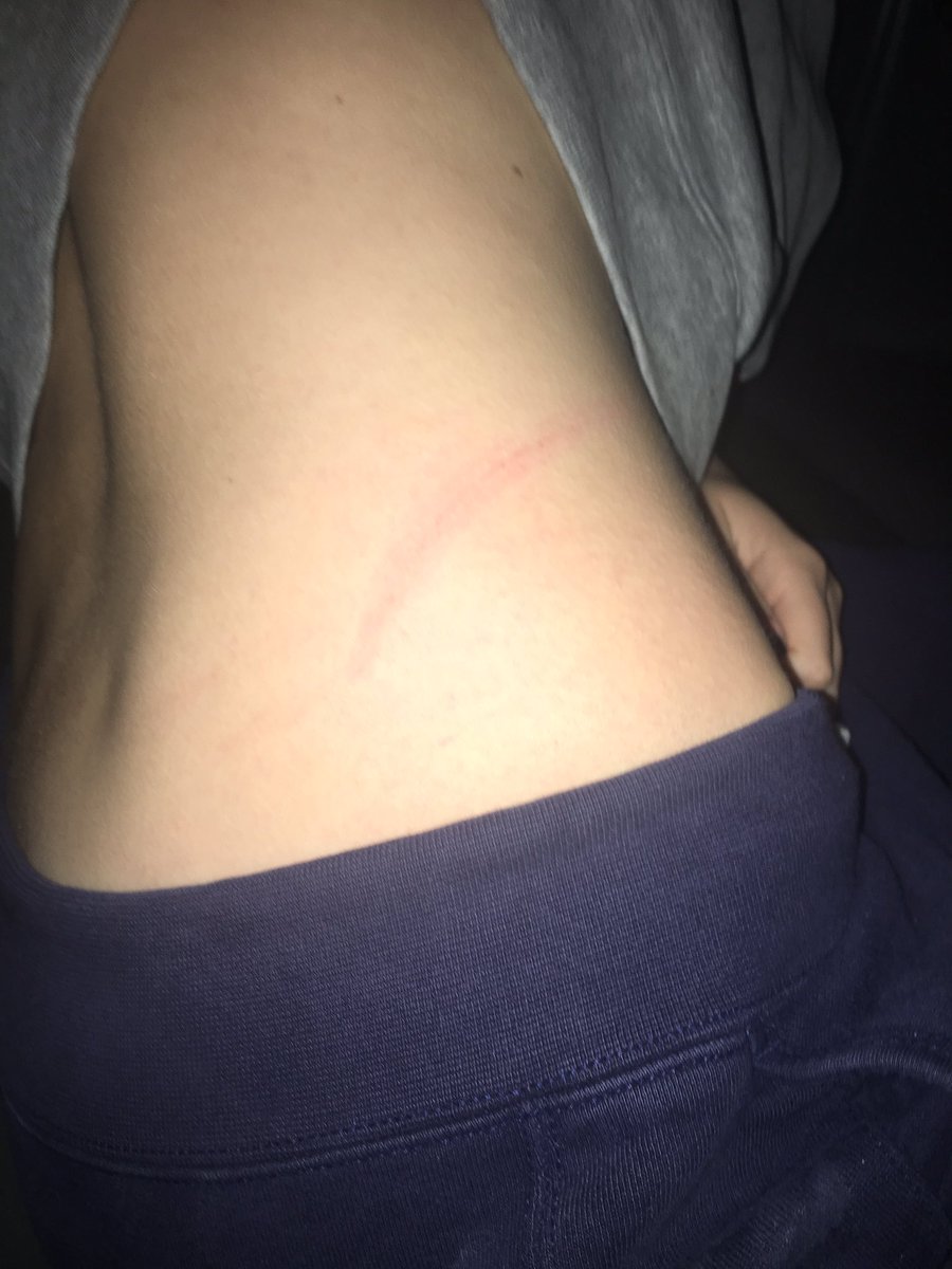 georgiecaney's tweet photo. @evie_caneyx at least I don't attack you 😢 https://t.co/xVNPbU6Bt5