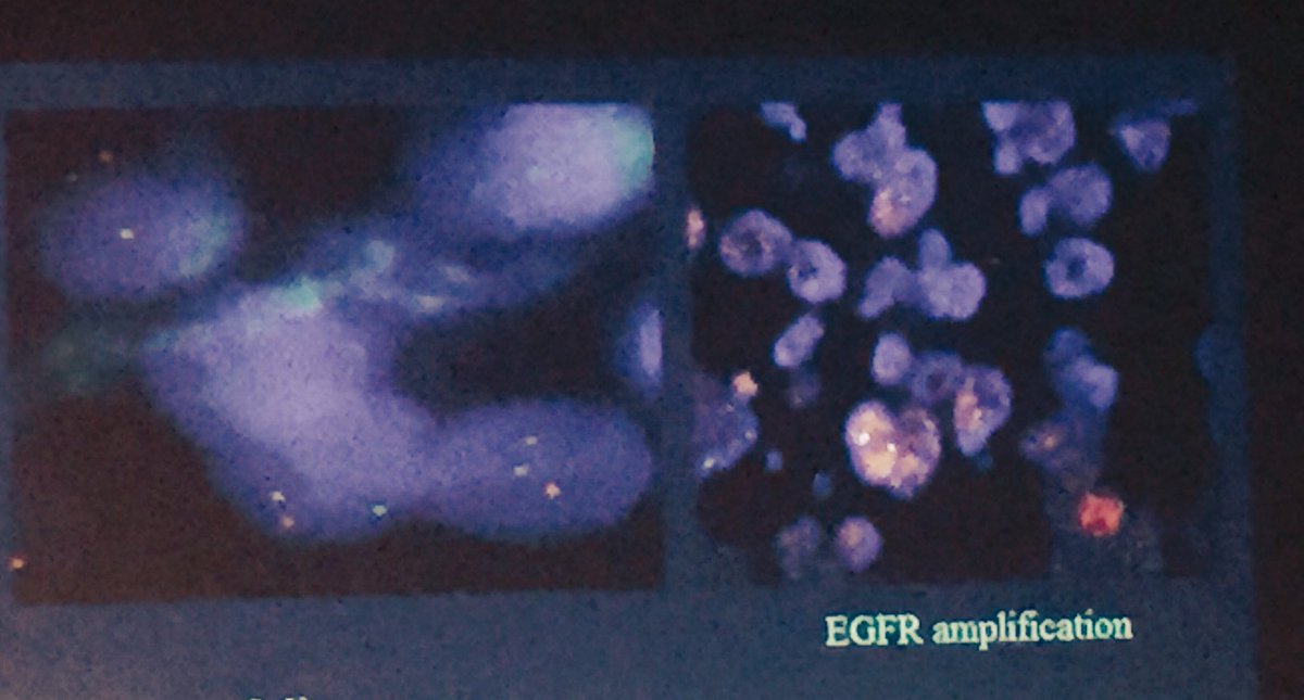 drruthmitchell's tweet photo. I love #FISH - so pretty. Also enjoy this #EGFR story #CINS16 https://t.co/LdIP6mJMgV