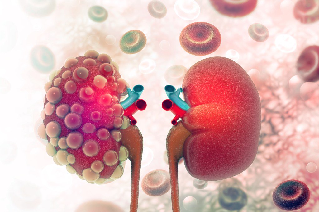 CKDnews's tweet photo. Reata to Initiate Phase 2/3 Trial of Therapy Candidate for Kidney Disease Caused by… https://t.co/4pOEpalwMA https://t.co/xYscNdD33J