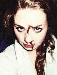 — ❝I survived. . . . I'm a Survivor . . .❞
