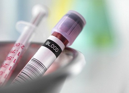 researz's tweet photo. Plasma from Teenage Blood Found to Have Anti-aging Effects in Old Mice https://t.co/WVliM8BUd4  #alkahest #plasmaa #neurogenesis #alzheimer https://t.co/MvN0Vg3Q3B