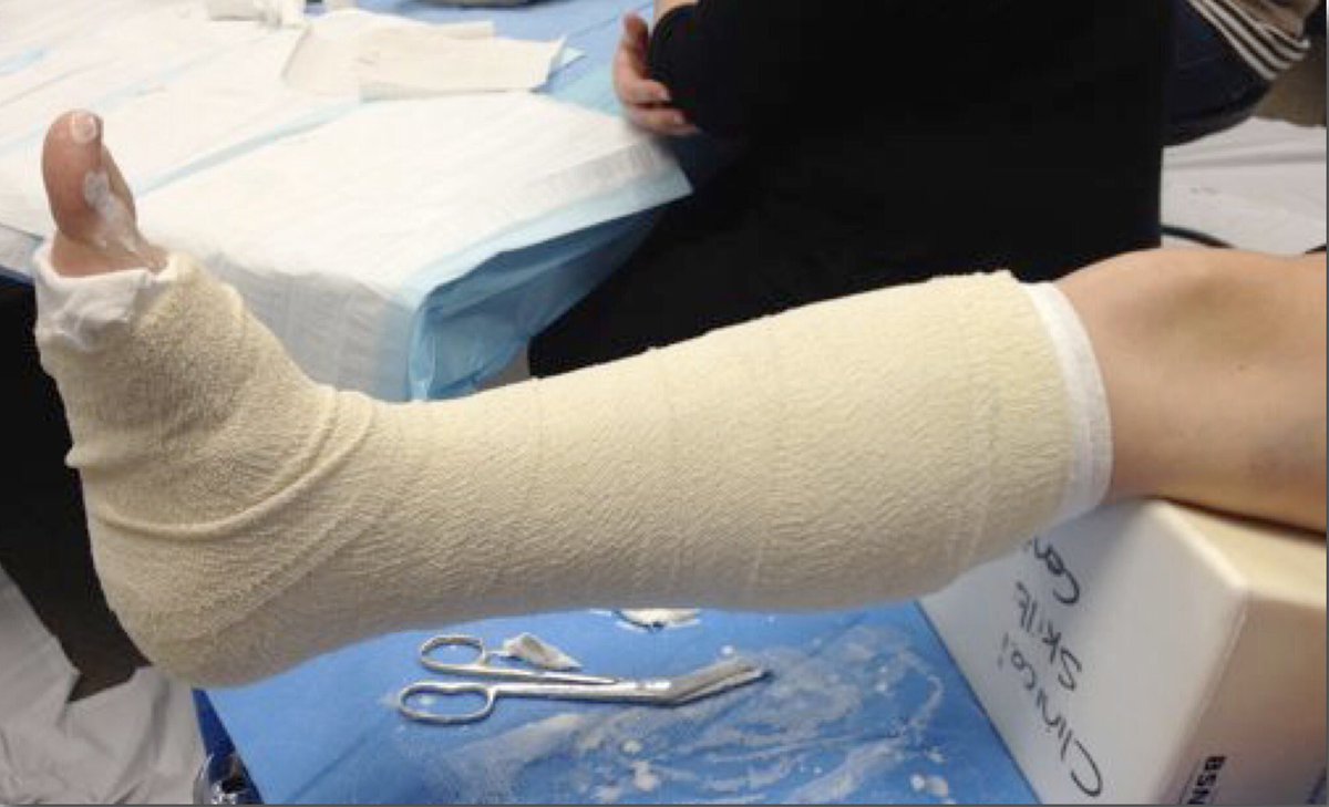 paulmcau's tweet photo. How can a story about a broken leg help a person with a schizophrenia? 
Well, it's a metaphor: https://t.co/Di2EkOg1h2 https://t.co/vcPw47ufK9