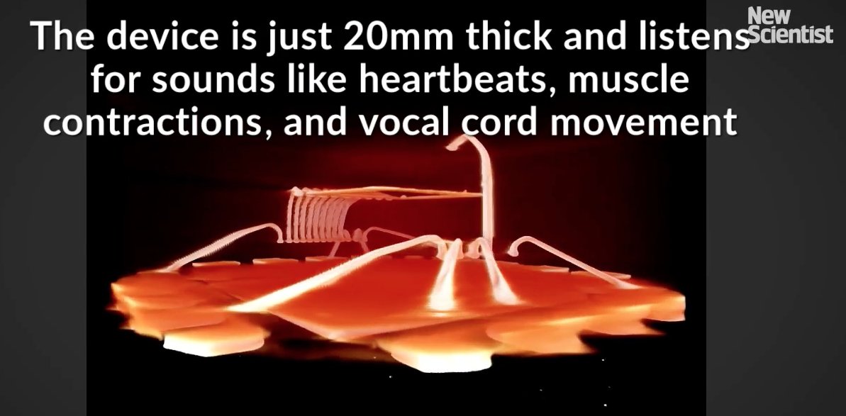 AugmentBiotech's tweet photo. An electronic tattoo listens to sounds in the body! #biotech #biology
https://t.co/aARk0AZuwD https://t.co/Gmvqkb9dGn