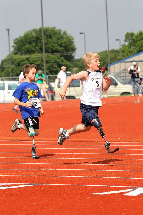 limbsforlife's tweet photo. #TBT Look how far #prosthetic technology has come.  Changing lives and restoring #amputees. https://t.co/W8eXzWcnJv