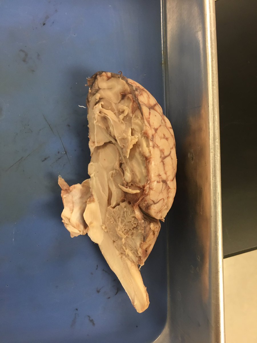 connor_handel's tweet photo. Brain Dissection @CooperSci #KytnSci https://t.co/2NALw9v4Iv
