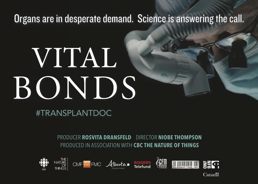 TUNE IN TONIGHT! VITAL BONDS premieres on CBC The Nature of Things w/ <a href="/DavidSuzuki/">David Suzuki</a> at 8PM! #transplantdoc
