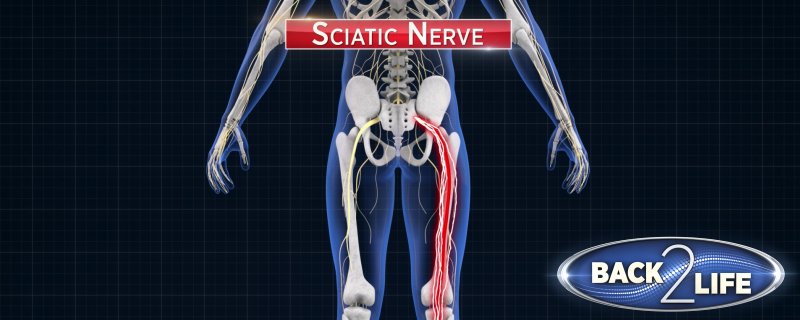 getBack2Life's tweet image. Sciatica pain can sometimes be unbearable, but Back2Life can provide much-needed relief. bck2.life/6WEoFQ