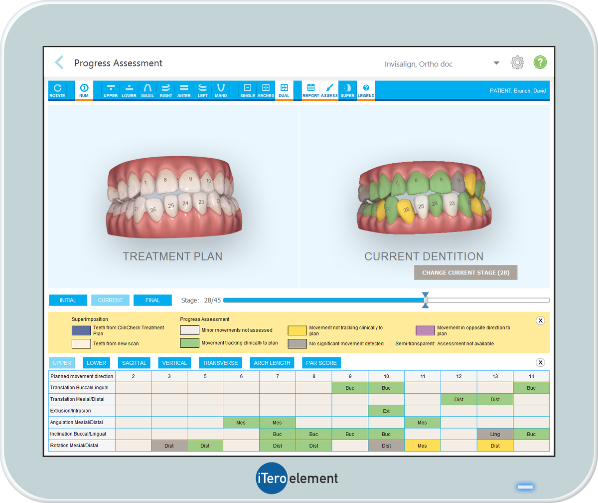 iTero Scanner on Twitter: "WEBINAR ON DEMAND: "Inspire Your Patients and Ignite Your Practice with the Invisalign® Outcome Simulator" https://t.co/ms9rd8npku… https://t.co/9udI49R7tn"