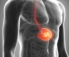john_zang11's tweet photo. Global #GastricCancerDrugs Market Research Report 2016 
https://t.co/QUmerY23Ai https://t.co/iJqHCu9L6E