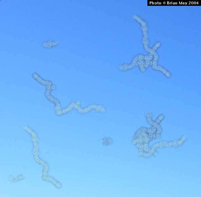 NeveVisual's tweet image. Hoje no blog falo sobre Moscas Volantes, mais um sintoma entóptico da Síndrome da Neve Visual nevevisual.blogspot.com.br