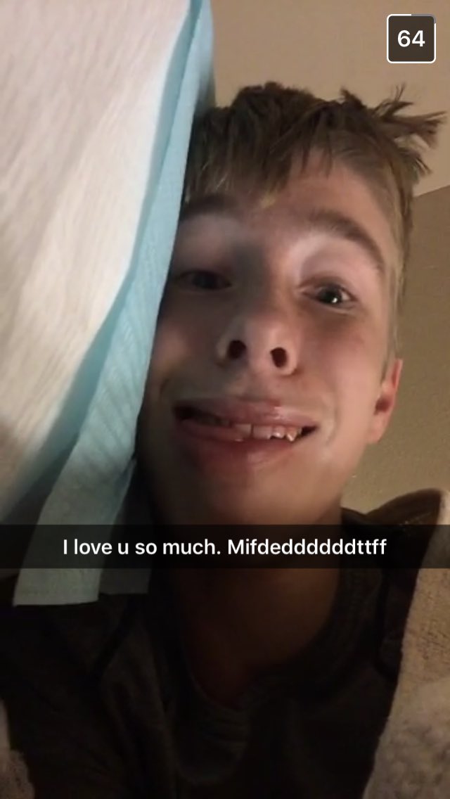 ryepesik's tweet image. guess who got their wisdom teeth out today!! 🤔