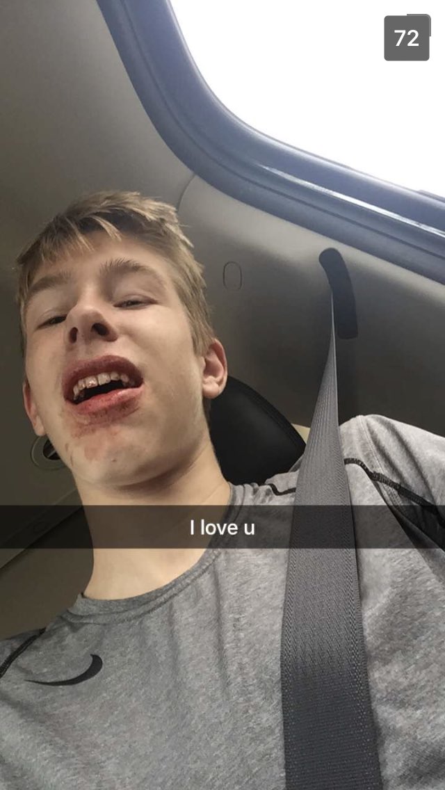 ryepesik's tweet image. guess who got their wisdom teeth out today!! 🤔