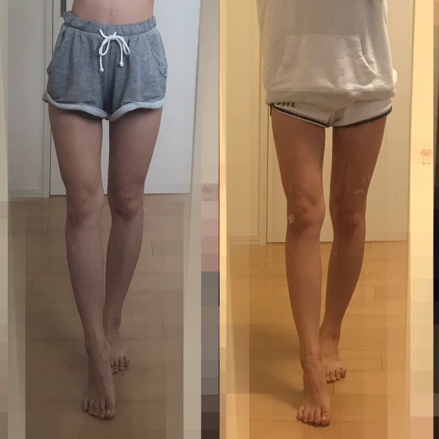ショートパンツ履きたい 生足で履いても許せる足の太さとは Re Now