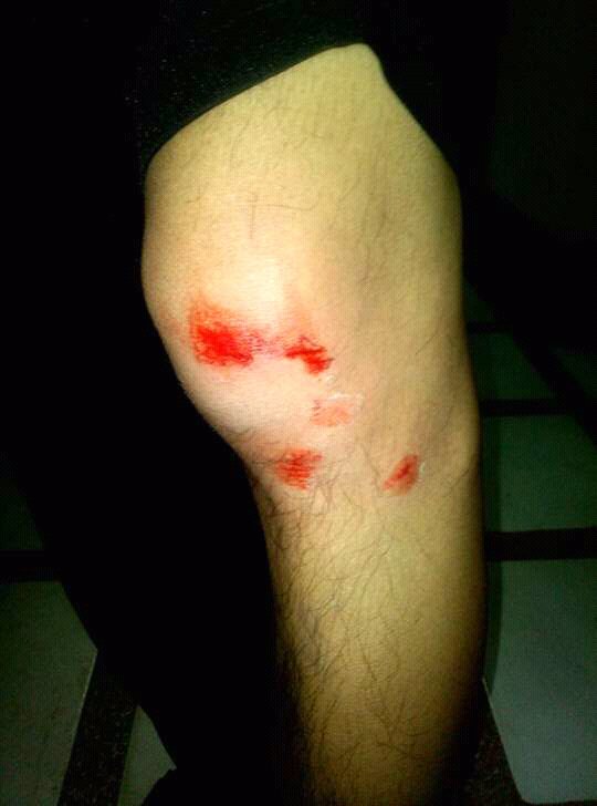 koywangca's tweet photo. Wag kang magmahal kung ayaw mong masaktan ,ayun tuloy  napangos ako sa katAngahAn ko😂😂😂😂😂😂😂 https://t.co/hUKKyu3mmJ