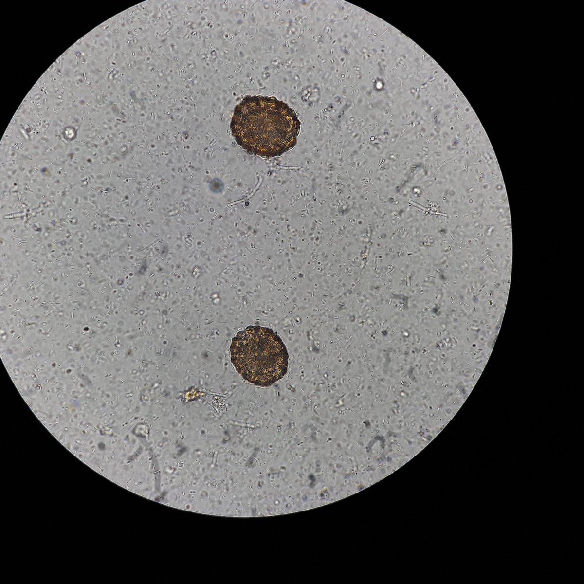 MedTechProblems's tweet image. Egg hunting tayo? 
#LabDiaries

(Puro nalang ganto laman ng phone ko)