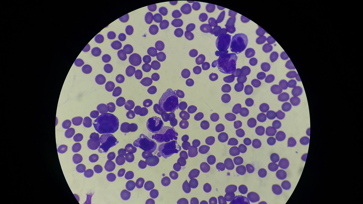 MedTechProblems's tweet image. 😱
#LabDiaries