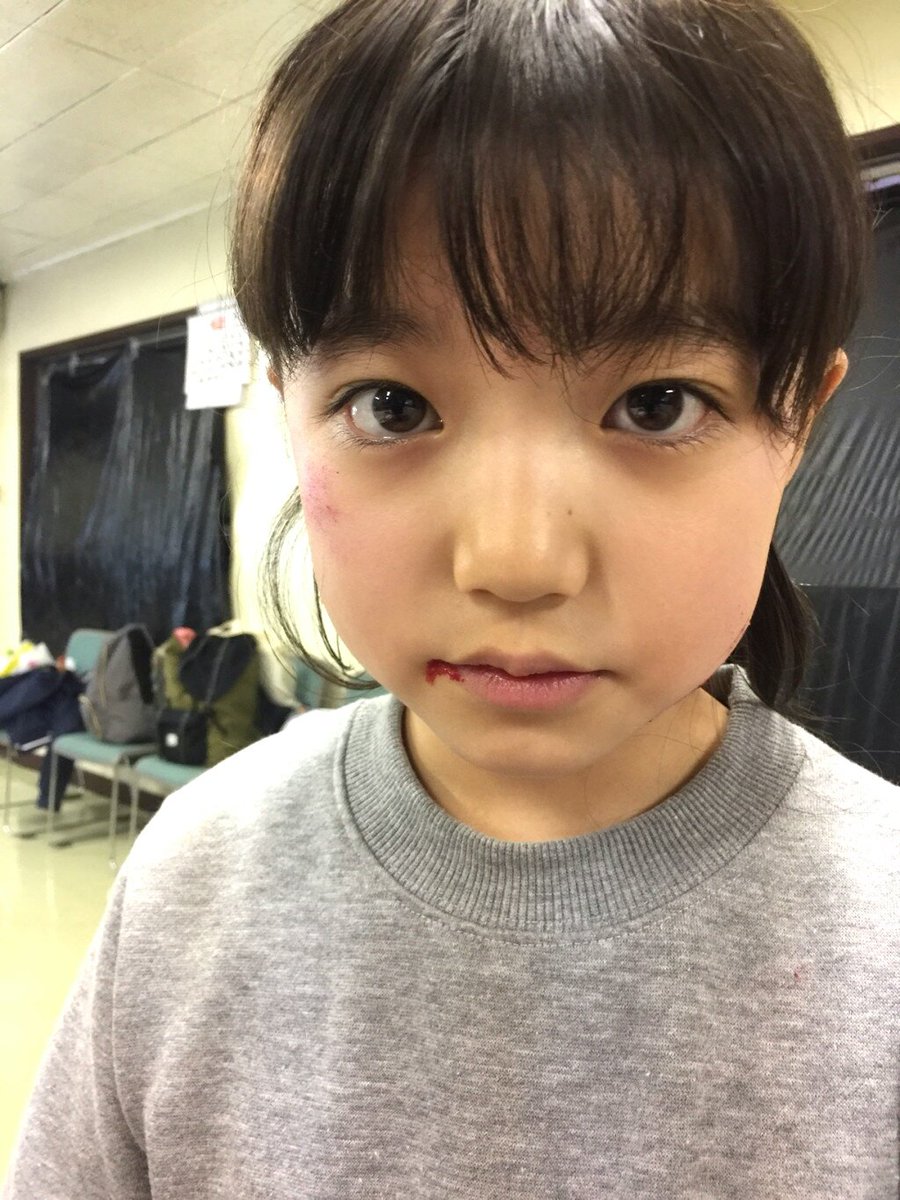 東京 子役チアー 子役を応援 No2 安藤美優 07 2 28 千葉県出身 ヒラタビーンズ所属 13 ドラマ 守護神 ボディーガード進藤輝3 16 ドラマ Chef 三ツ星の給食 13 Cm リクルートカード パー子役 14 Mv a Love 他 T Co