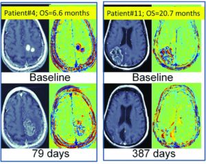 TheAJNR's tweet photo. Editor's Choice: Early Biomarkers from Conventional and Delayed-Contrast ... - https://t.co/SptzgNoIig #NeuroRad https://t.co/1mFpFxK7FS