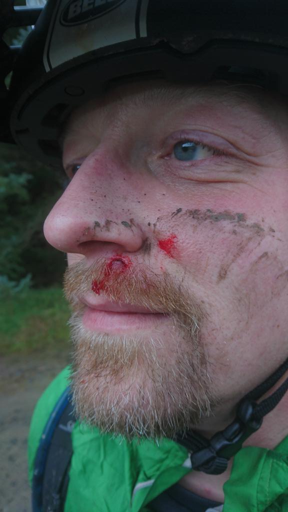 It was a bit cold at <a href="/BikeParkWales/">BikePark Wales</a> today! ❄ And one of the boys liked his stem so much, he kissed it. #ouch #swmtb