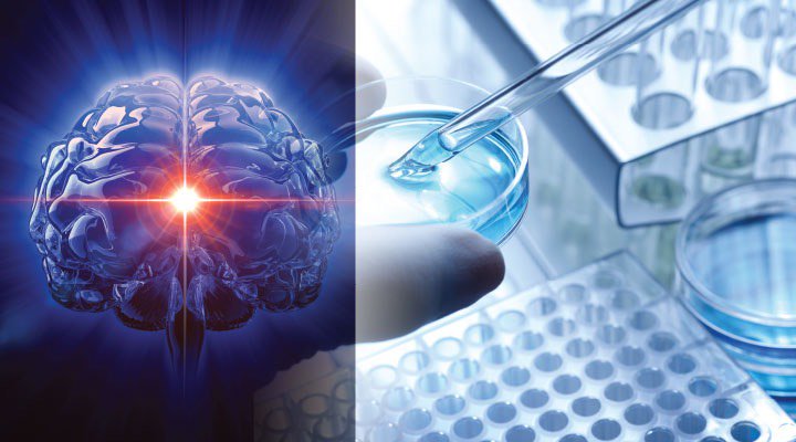 New Method to Slow #Brain #Aging - Life Extension goo.gl/kimGHo