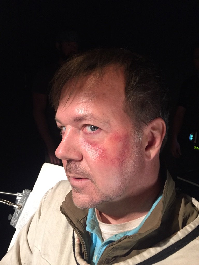 sugarpuss's tweet photo. WHUT WHUT!? Look at that bruise!!! #Mine #TheLibrarians #BecauseMakeUp https://t.co/bxMTTtxmtS