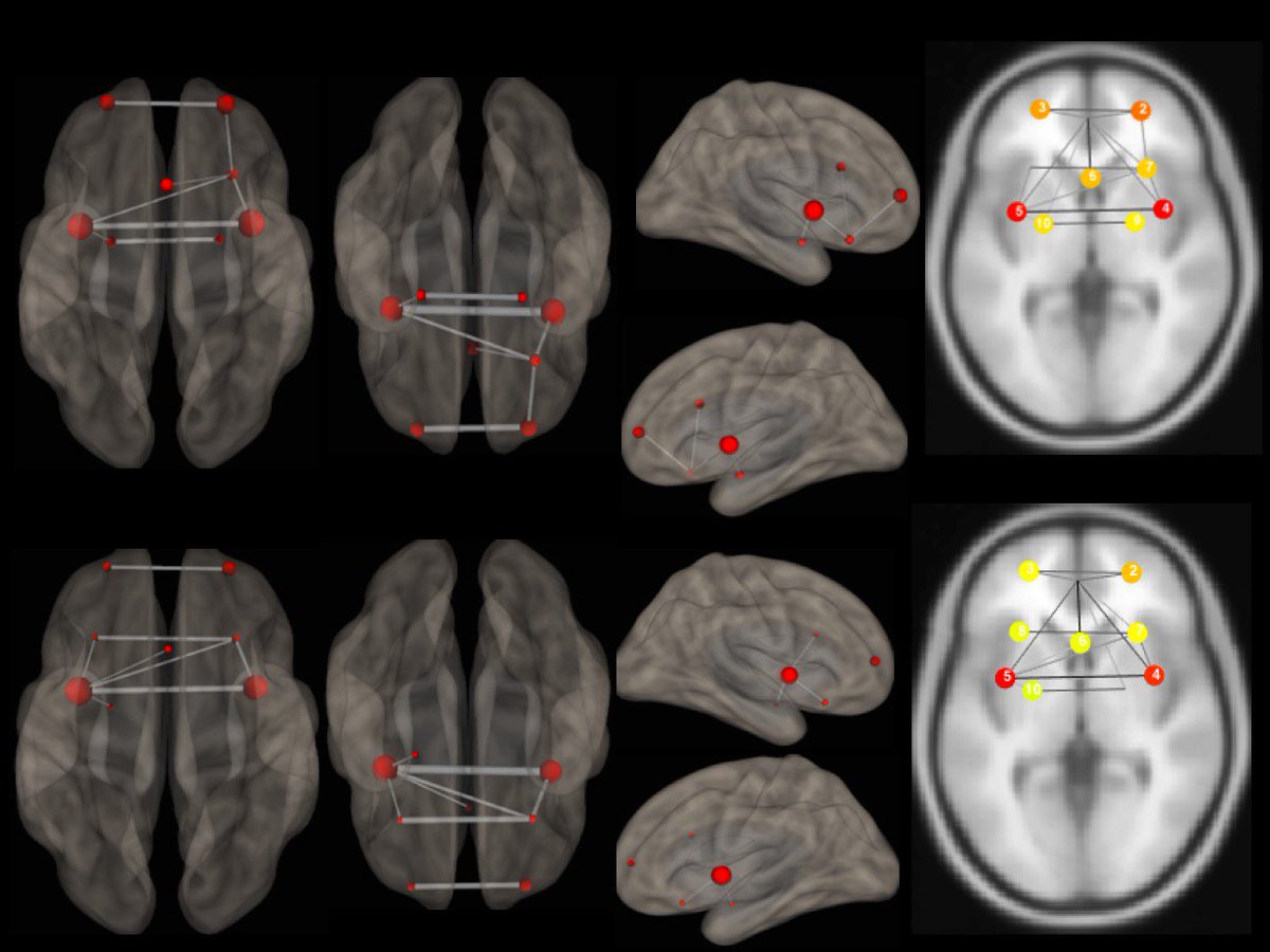 endoxaneuro's tweet image. The brain is all about wiring and so we are! At #endoxaneuroscience  #neurotechx  #neurotechSR we help you understand how the brain is wired