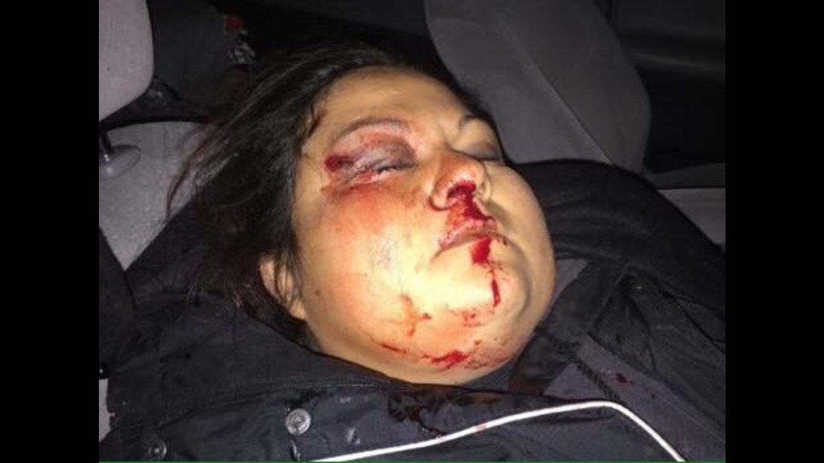 joshfoxfilm's tweet image. Dear MSM, we are not rioters. We are peaceful. This is 400 yrs of Native history. The cops are brutal. This is the violence of oil &amp;amp; gas.