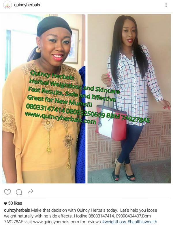 Ofashionexpress's tweet photo. Fight obesity with @QuincyHerbals1 weight loss powder supplement. Bbm pin: 7A98278ae   / ig @QuincyHerbals1 https://t.co/mIWmgIUAMY