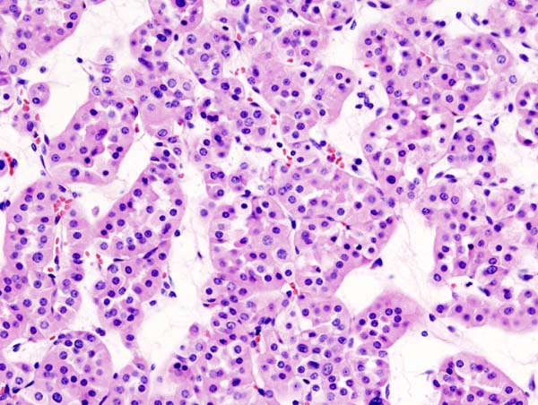 fridobruehl's tweet photo. Hometown Legend Karl Hürthle. In Hürthle adenoma. Also metaplastic response of follicular epithelium in Hashimotos https://t.co/pFpOI3qfX4