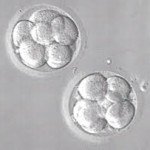 InViaFertility's tweet photo. #IVFQuestions: My eggs didn't fertilize! Is there anything we can do?https://t.co/8dany1maV2 #fertility #infertility https://t.co/SAkdOSiNM8