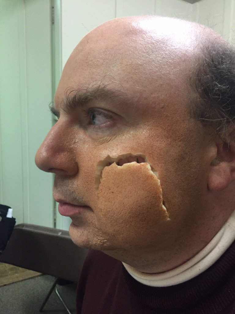 sugarpuss's tweet photo. FINKLESTEIN! Eeew his flesh bag coming off. Wonderful fx work by our MUA Morgan Muta. #TheLibrarians #BecauseMakeUp https://t.co/chpwbuGnHi