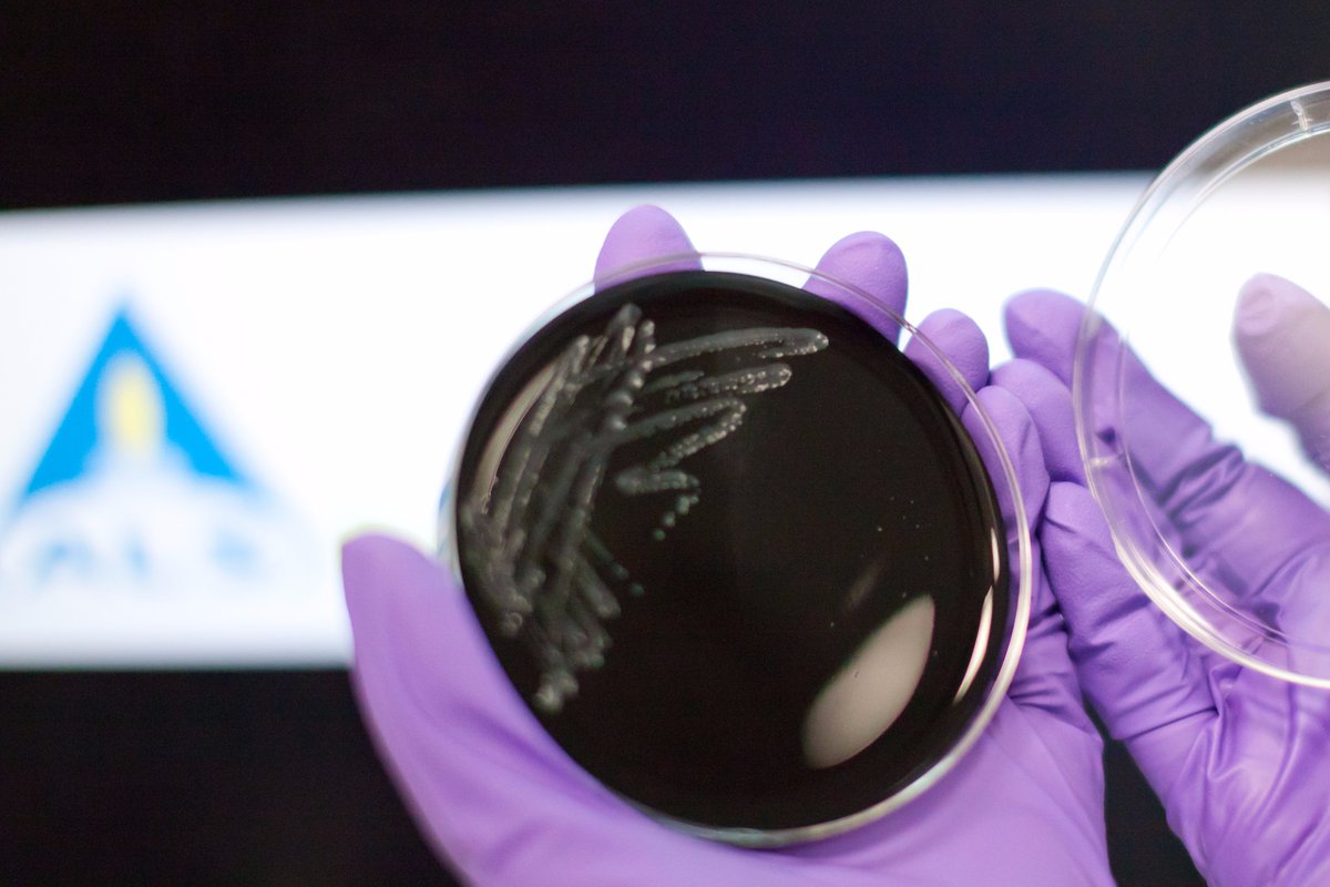 ALSUKIreland's tweet photo. Extended #Legionella Capacity at ALS Coventry, more here: https://t.co/KJzFkM4O0l #alsenvironmental #laboratory #malditof #analysis #testing https://t.co/DvdtoFNAnW