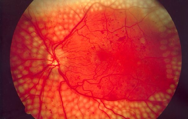 vincentmenezes's tweet image. #Google is using its
#deeplearningtech~to

#diagnosedisease...

bit.ly/2h69bfa .@PopSci