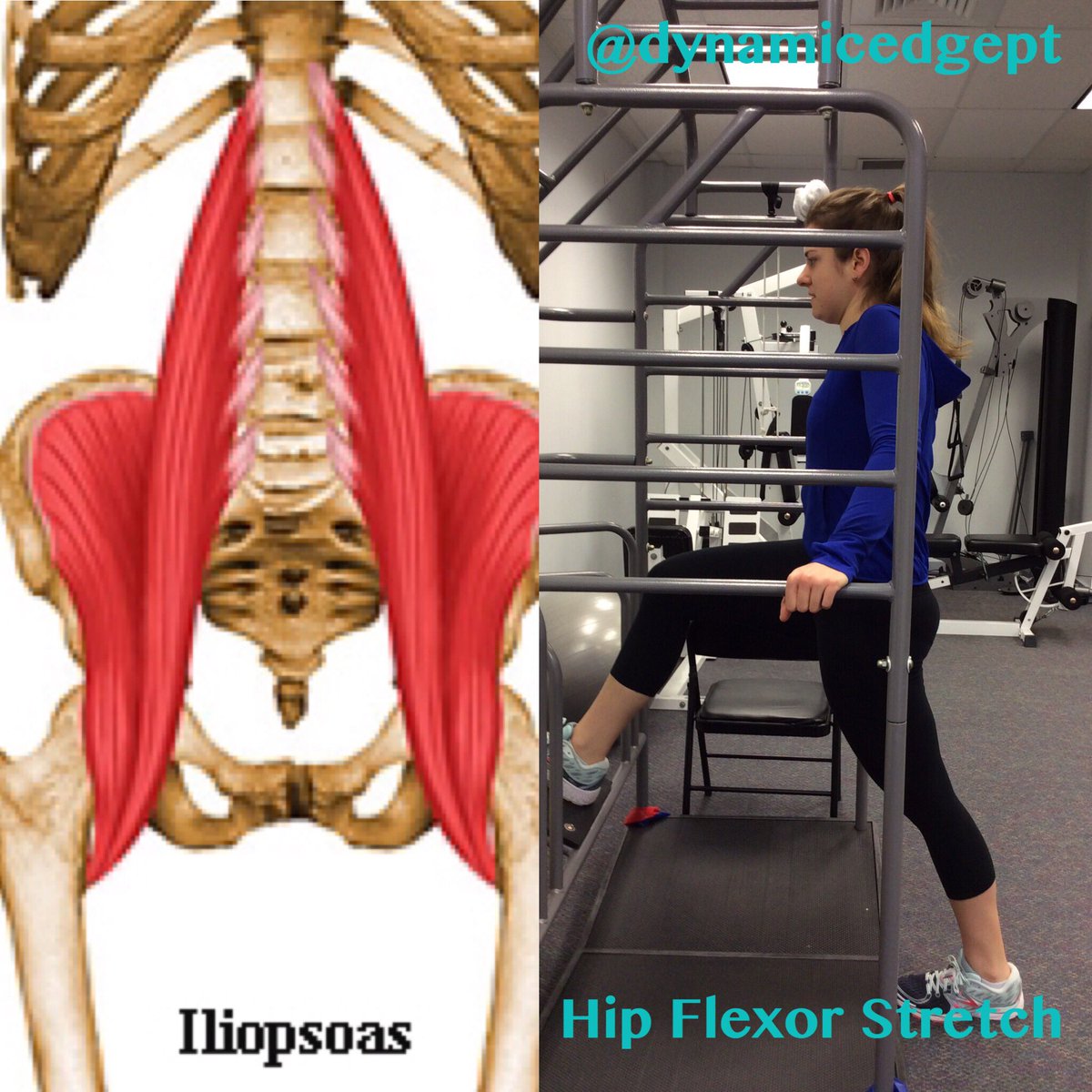 DynamicEdgePT's tweet photo. Did you know tight hip flexors can be the cause of lower back pain? #lowbackpain #stretching #fitness #injuryprevention #truestretch https://t.co/rcrQiHKwYe