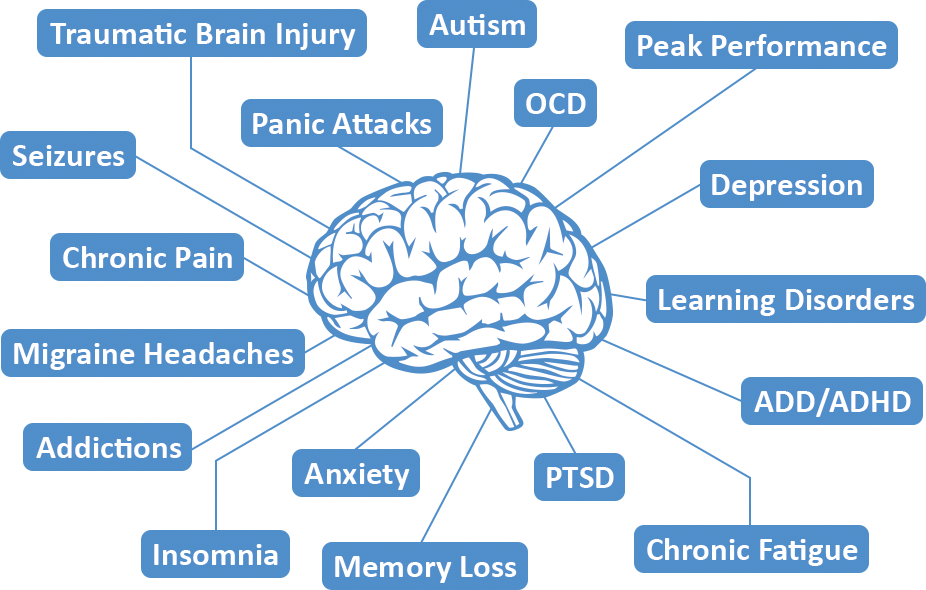 Brain disorders. Мозг аутиста. Тревога мозг. Мозги текст. PTSD Brain.