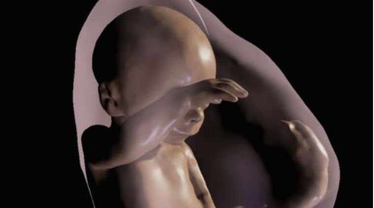researz's tweet photo. New Technology Uses Virtual Reality to View and Understand a Developing Foetus https://t.co/hT2xddfooL #4Dultrasound #healthcareindustry https://t.co/4G7tGjYQaP