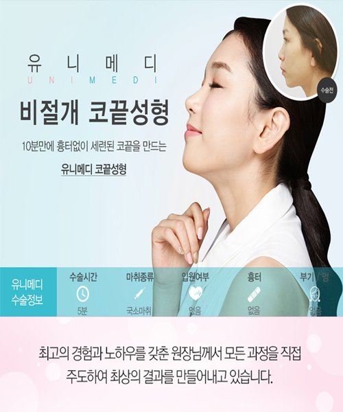 stepmail3's tweet image. ▶ 자세히 보기
self-ad.co.kr/ad/2581

▲전후사진 보러가기▲
10분만에 흉터없이 세련된 코끝을 만드는
유니메디 비절개 코끝성형