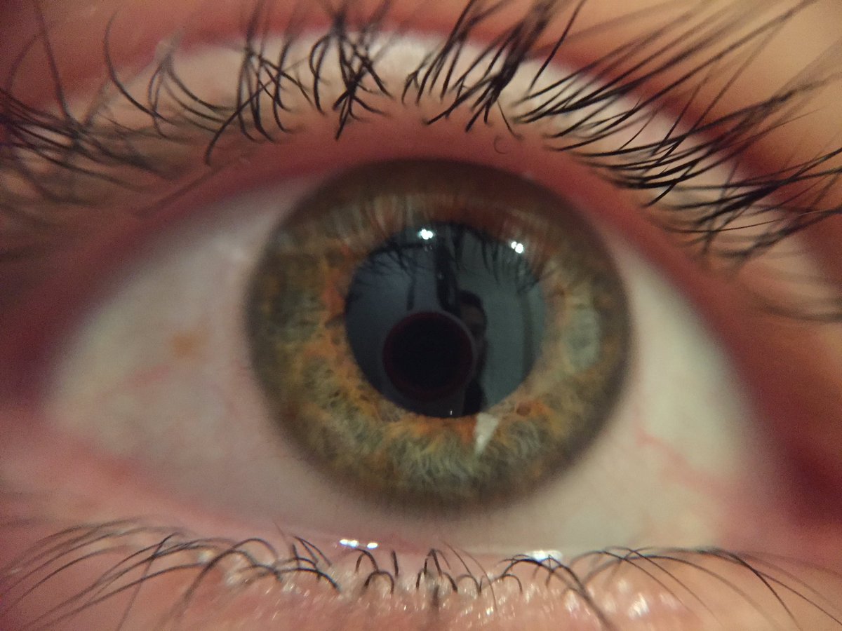 eypee's tweet photo. I got orange in my eyes. https://t.co/pKm8QACXAF